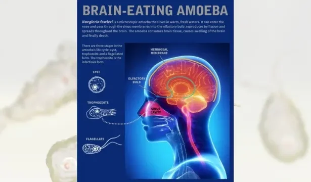 Awareness poster about preventing brain eating amoeba infections
