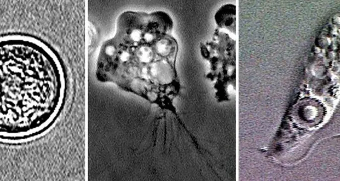 Microscopic view of brain-eating amoeba Naegleria fowleri