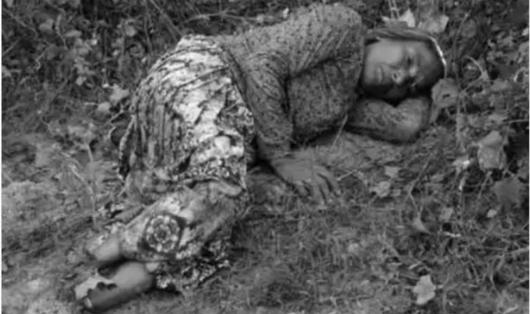 Victim Kamala Devi after brutal attack in Sawai Madhopur